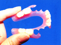 ナチュラルデンチャーの特徴