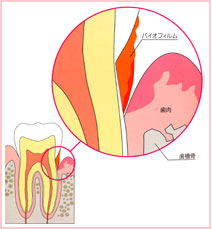 バイオフィルムとは