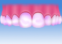 口の状態のチェック